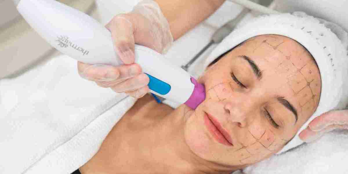 What Makes Thermage Skin Tightening in Dubai So Effective?