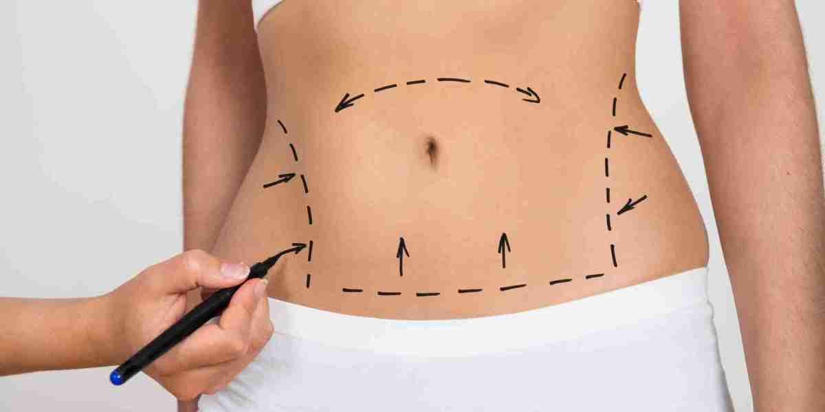 Why Bariatric Surgery in Islamabad Is Becoming a Popular Weight Loss Solution