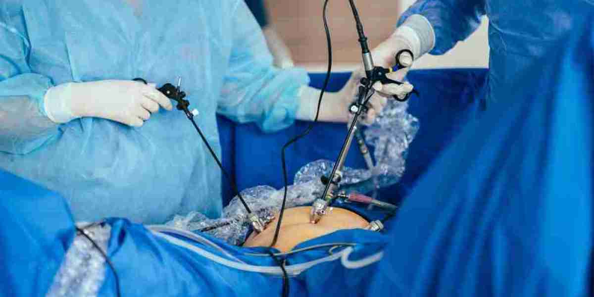How Does Laparoscopic Surgery Compare With Traditional Surgery?