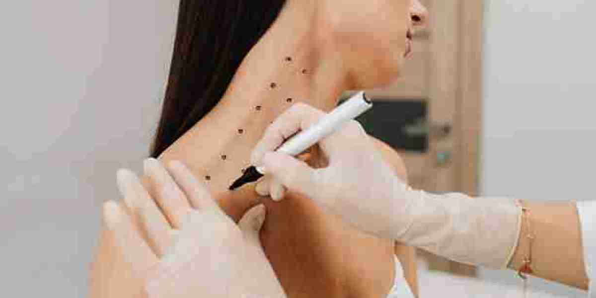 Nefertiti Lift Treatment in Dubai for Firmer Skin