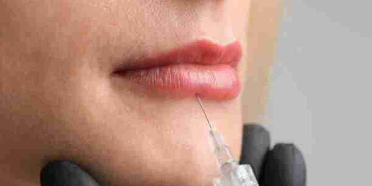 Lip Filler Injection in Dubai: Your Path to Natural Results