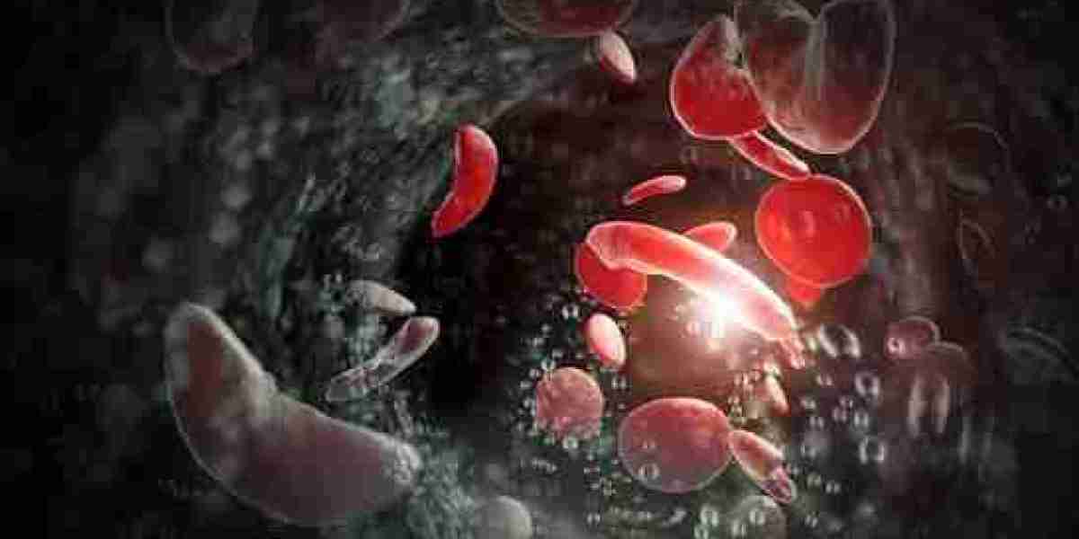 Global Sickle Cell Disease Treatment Market Driven by Increasing Rare Disease Research and Biopharmaceutical Innovation