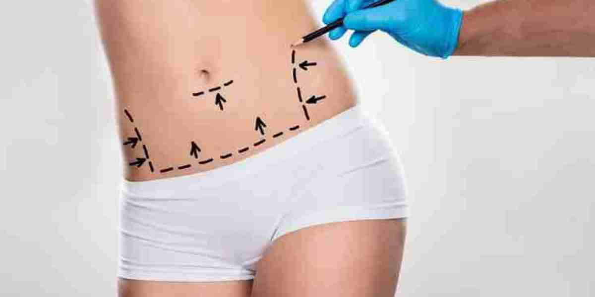 Mommy Makeover Dubai: How to Prepare for Your Recovery