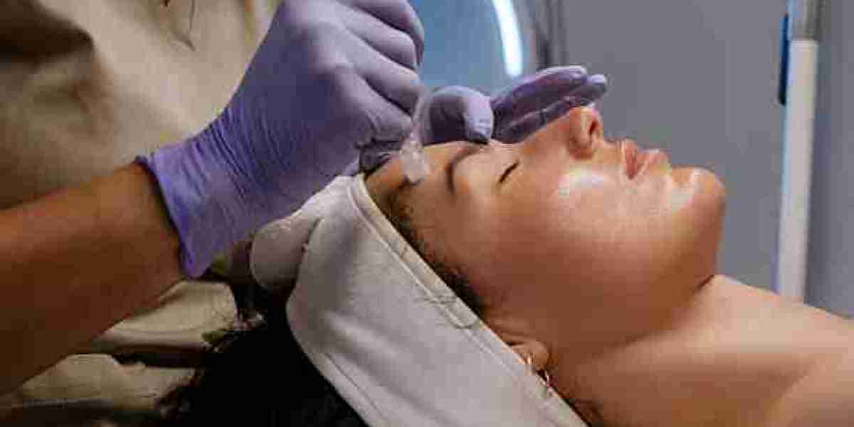 What Drives Facial Prices Up or Down