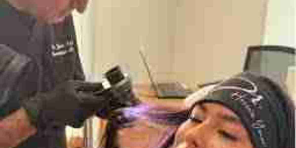 A Beginner's Guide to PRP Hair Treatment in Abu Dhabi | Natural Hair Restoration