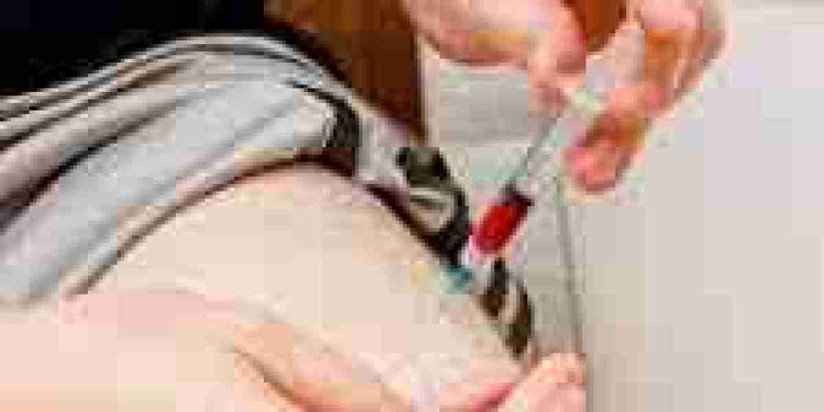 P Shot in Dubai | What to Know Before Treatment