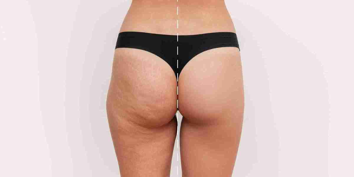 Expert Guide to Brazilian Butt Lift Clinics in Dubai