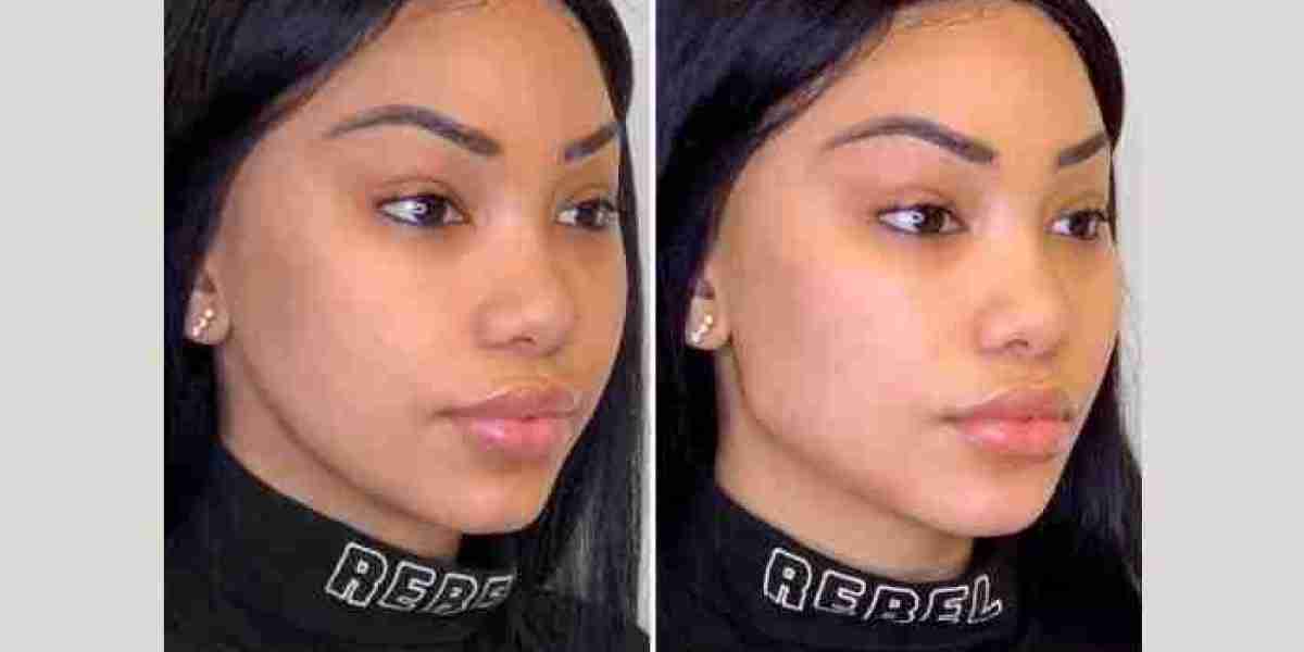 Thread Lift in Dubai Using PDO Threads Safely