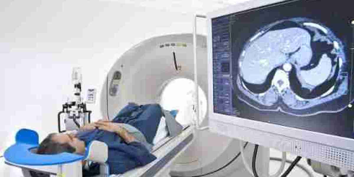 Medical Imaging Market Insights: AI, MRI, CT, and Digital Radiology Fuel Global Growth