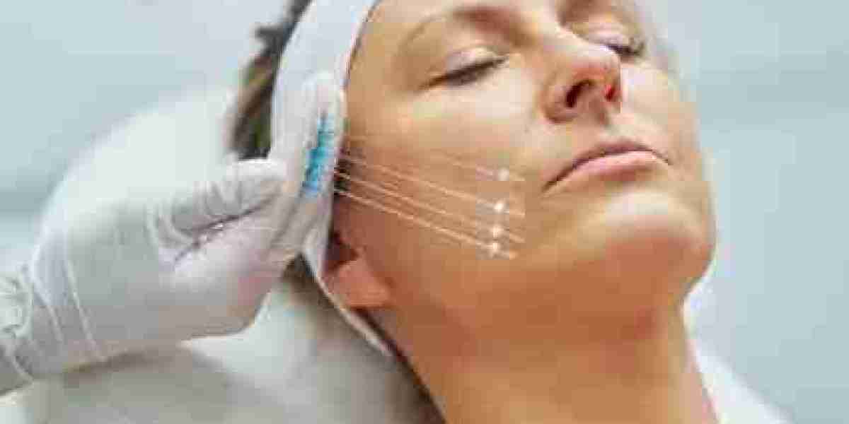 Thread Lift in Dubai: Definitive Protocol for Facial Re-Suspension