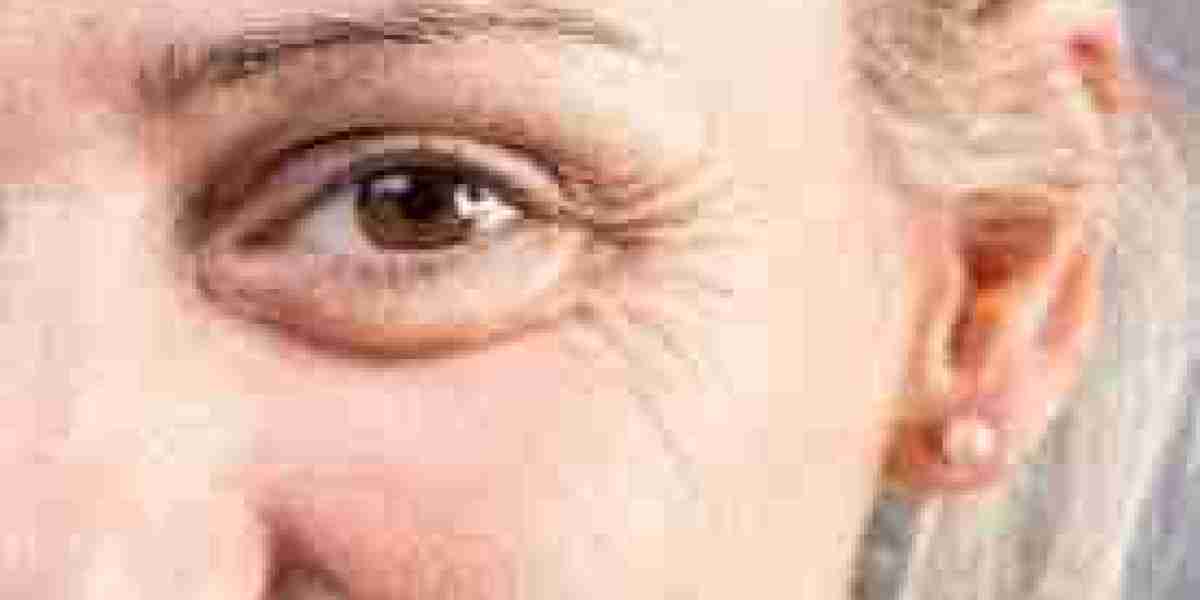 How Fine Lines and Wrinkles in Dubai Can Be Minimized Effectively | Complete Anti-Aging Guide