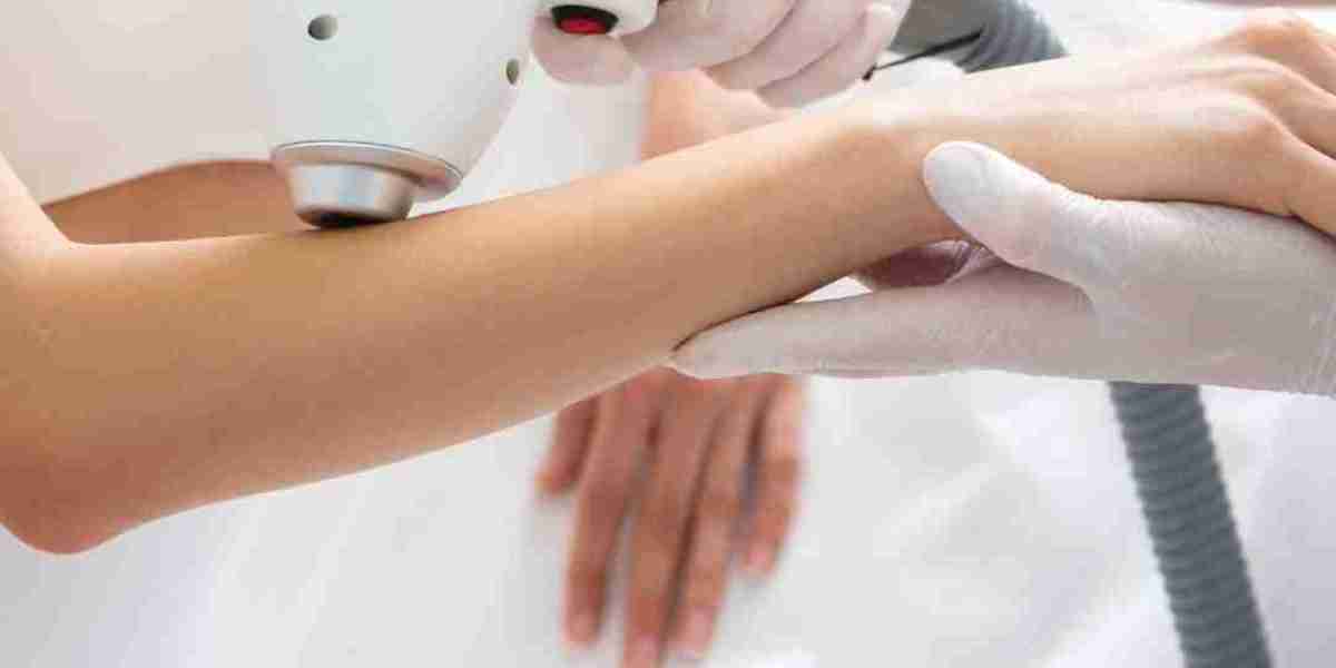 Laser Hair Removal in Dubai: How to Choose the Right Clinic