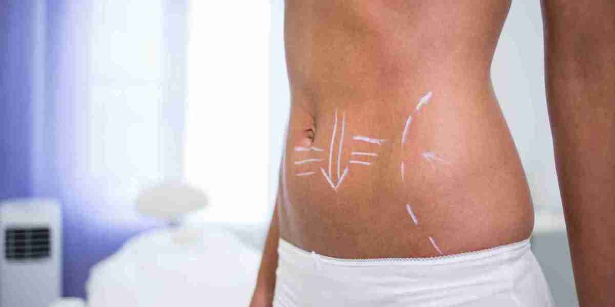 Best Tummy Tuck Surgeon in Dubai: What Happens During the First Consultation?