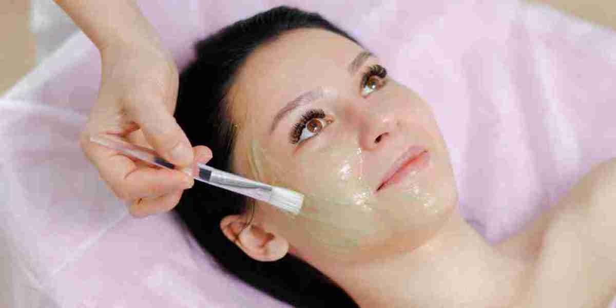 Chemical Peel in Croydon: A Personalized Approach to Smoother, Brighter Skin